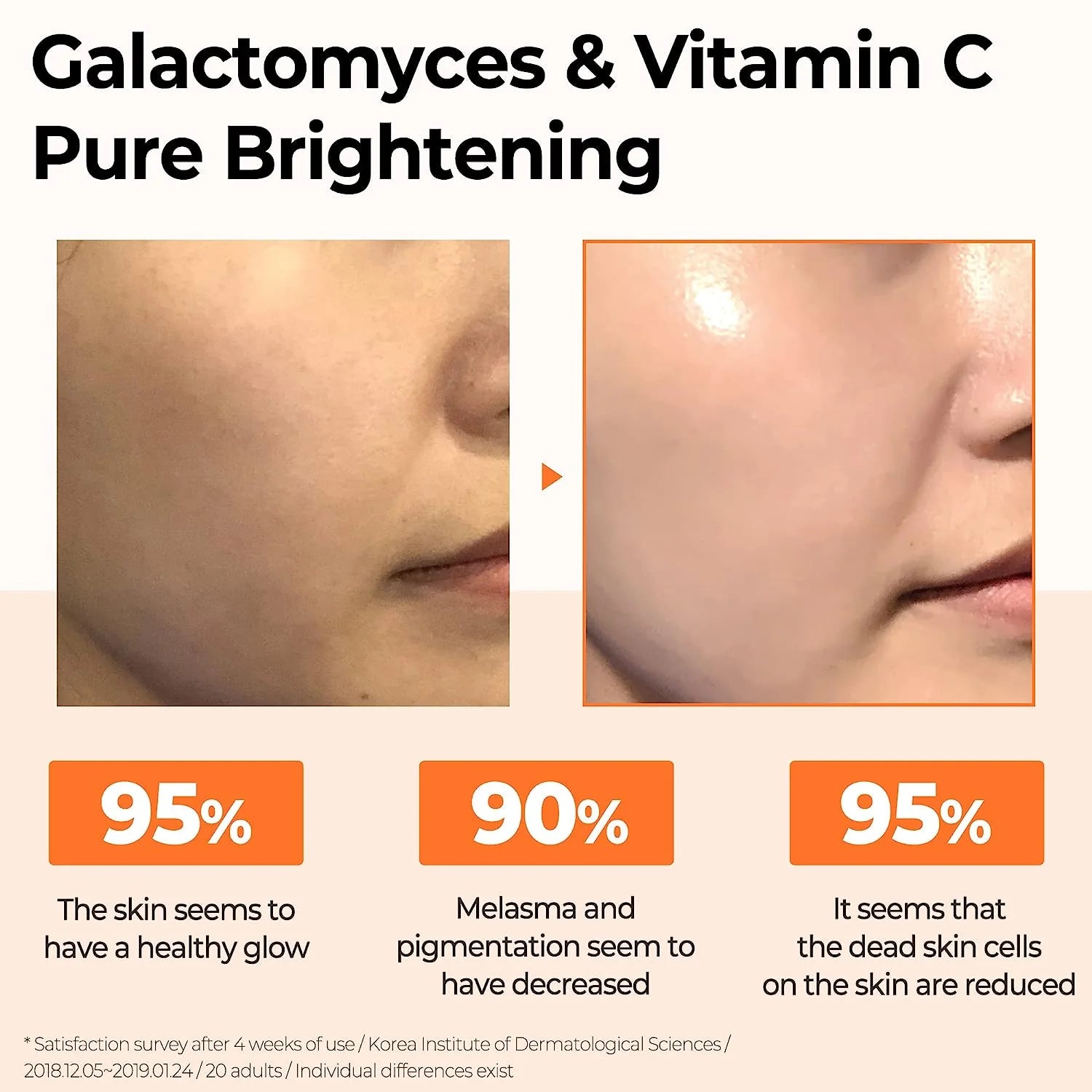 Some By Mi Galactomyces Pure Vitamin C Glow Serum